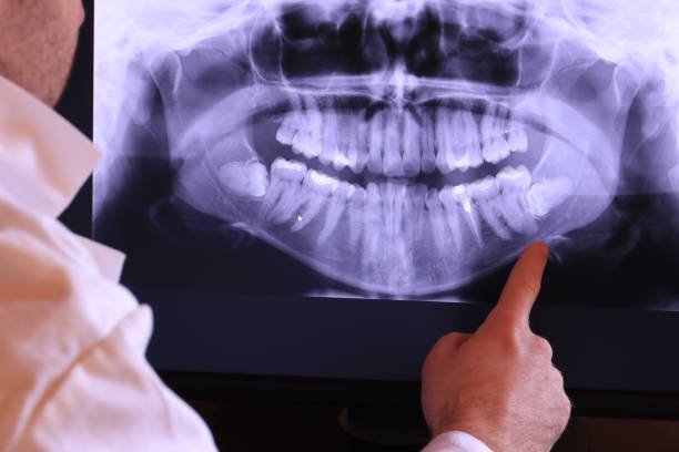 Best Emergency Treatment for Jaw Pain or Injury in Half Moon, NC