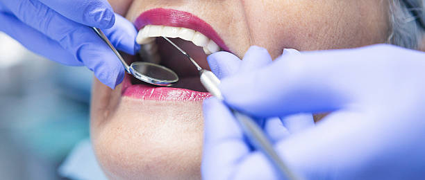 Best Broken or Chipped Tooth Repair in Half Moon, NC